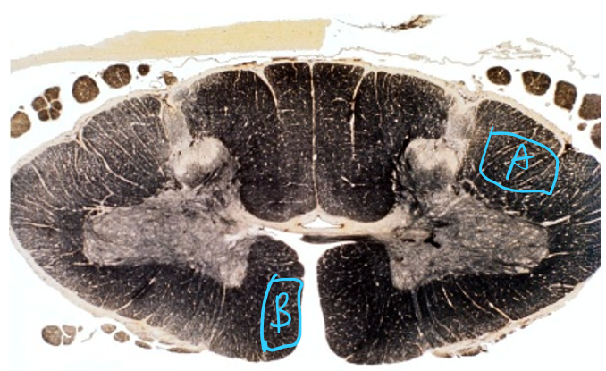 <p>Consider A and B. Describe the path of the neurons.</p>