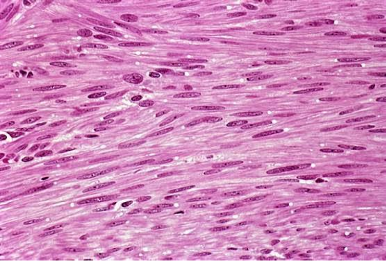 <p>what is this tissue</p>