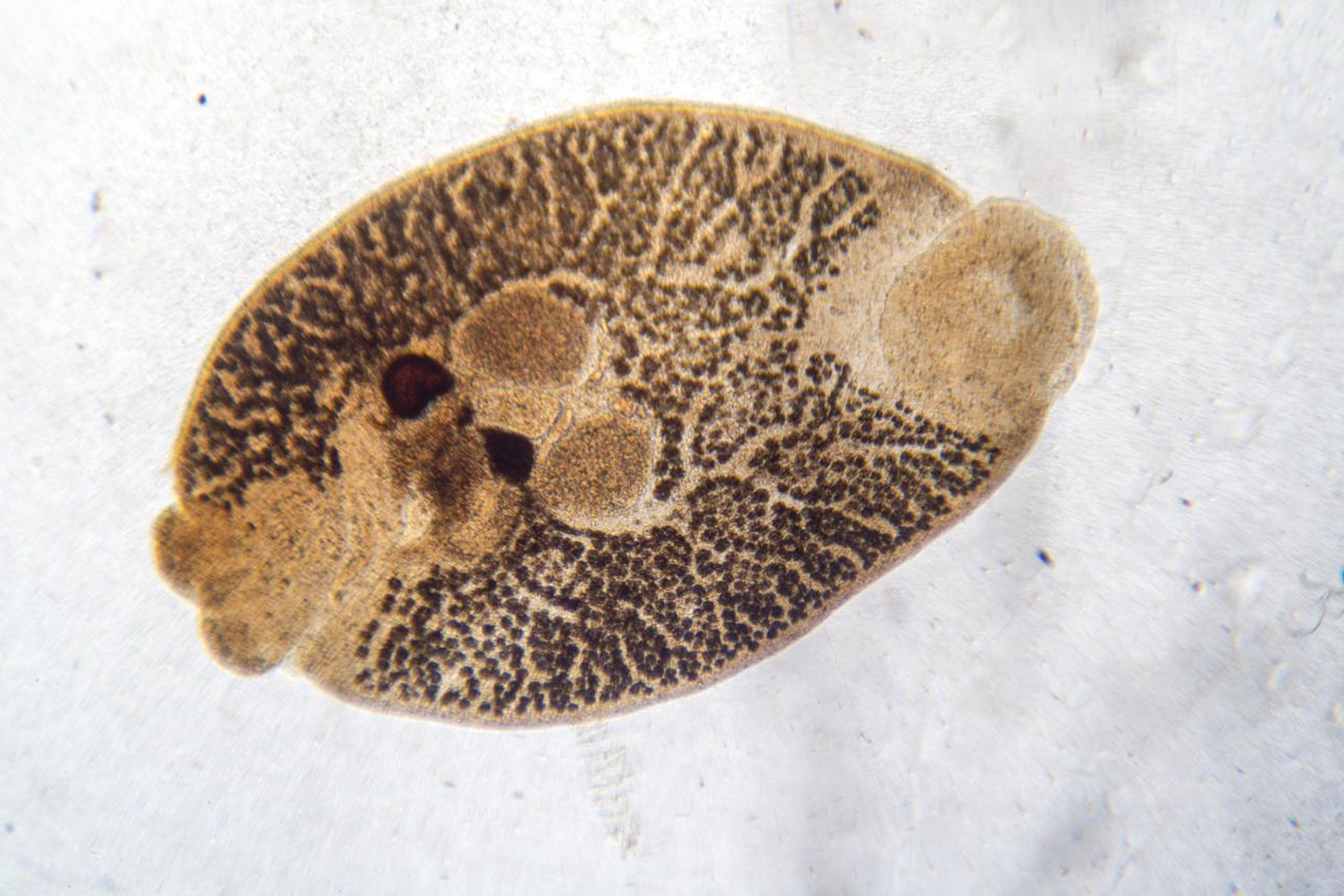 <p><span data-name="worm" data-type="emoji">🪱</span> <strong>Class Trematoda</strong></p>