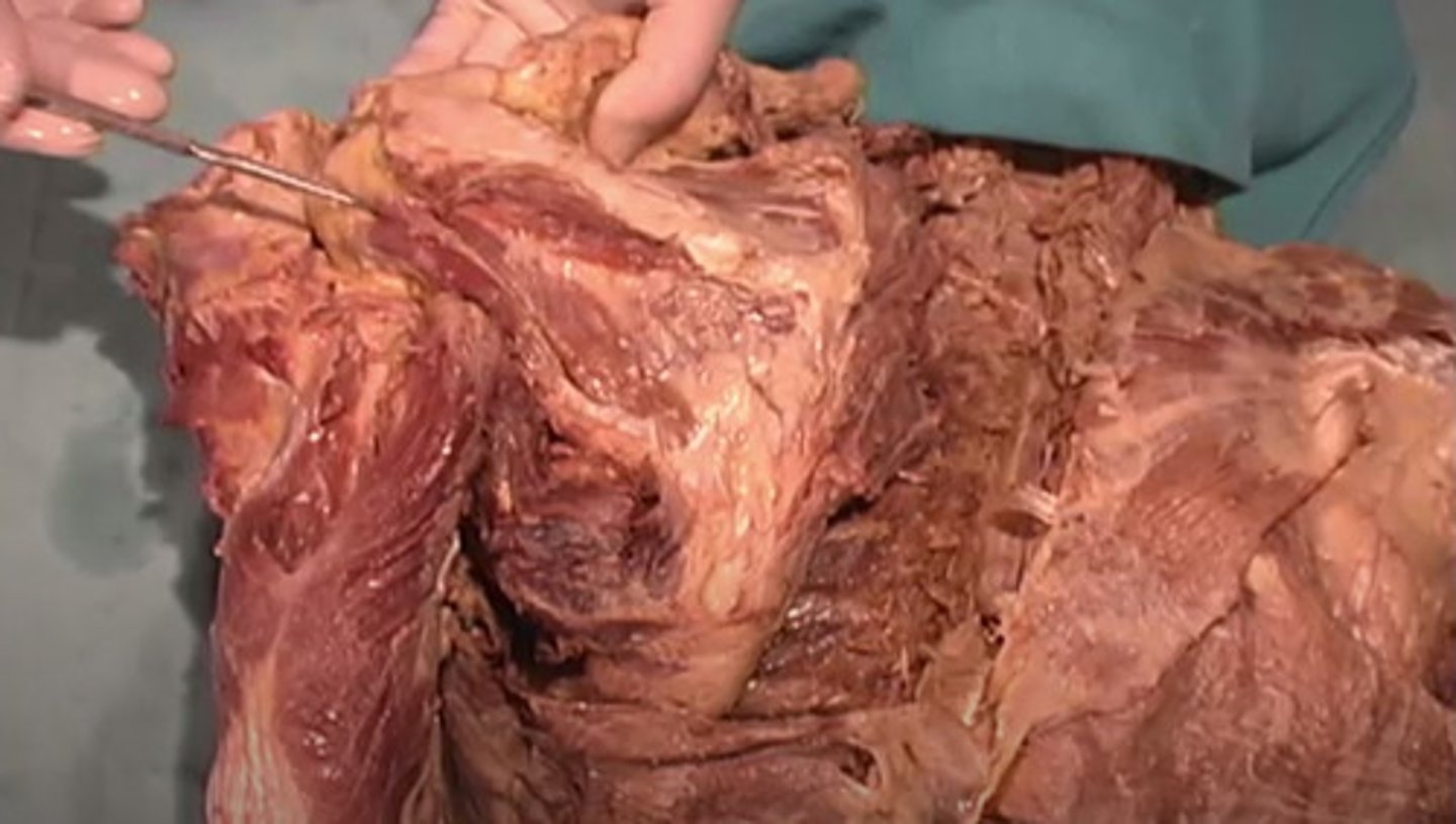 <p>The __________________ ____________________ is actually comprised of 4 muscles that are known as the Subscapularis muscle, the Teres minor muscle, the Supraspinatus muscle and the Infraspinatus muscle</p>