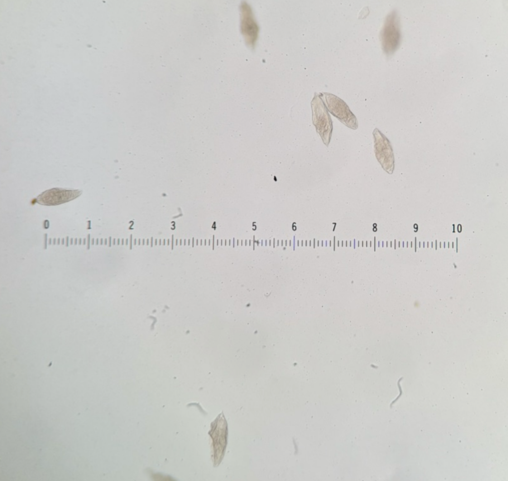 <p>Kingdom?</p><p class="p1">Phylum?</p><p class="p1">Class?</p><p class="p1">Subclass?</p><p class="p1">Order?</p><p class="p1">Family?</p><p class="p1">Species/Stage?</p>