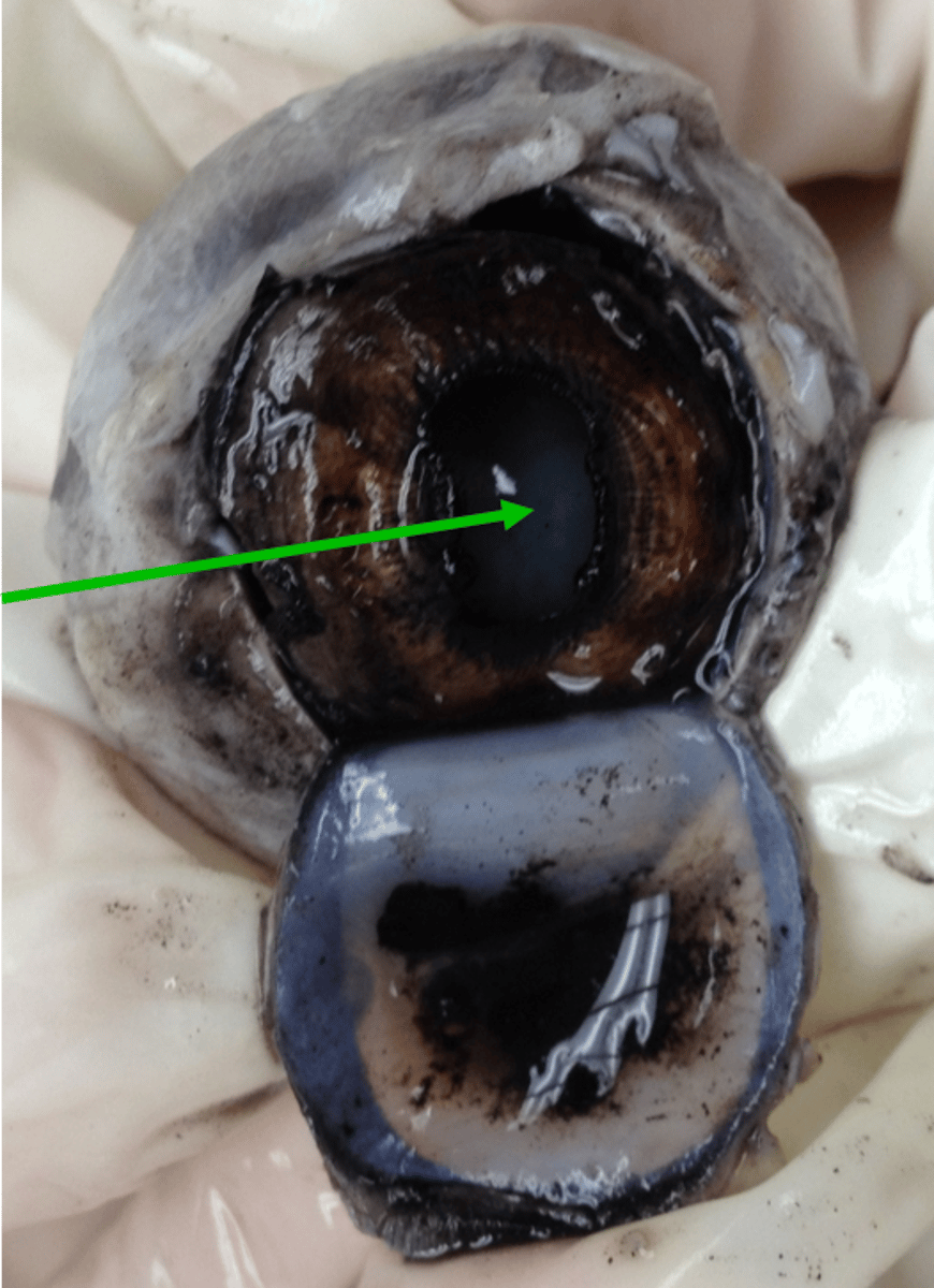 <p>opening in the center of the iris</p>