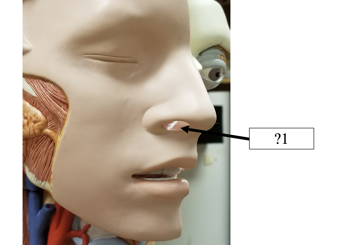 <p>1 Name the hole?</p>
