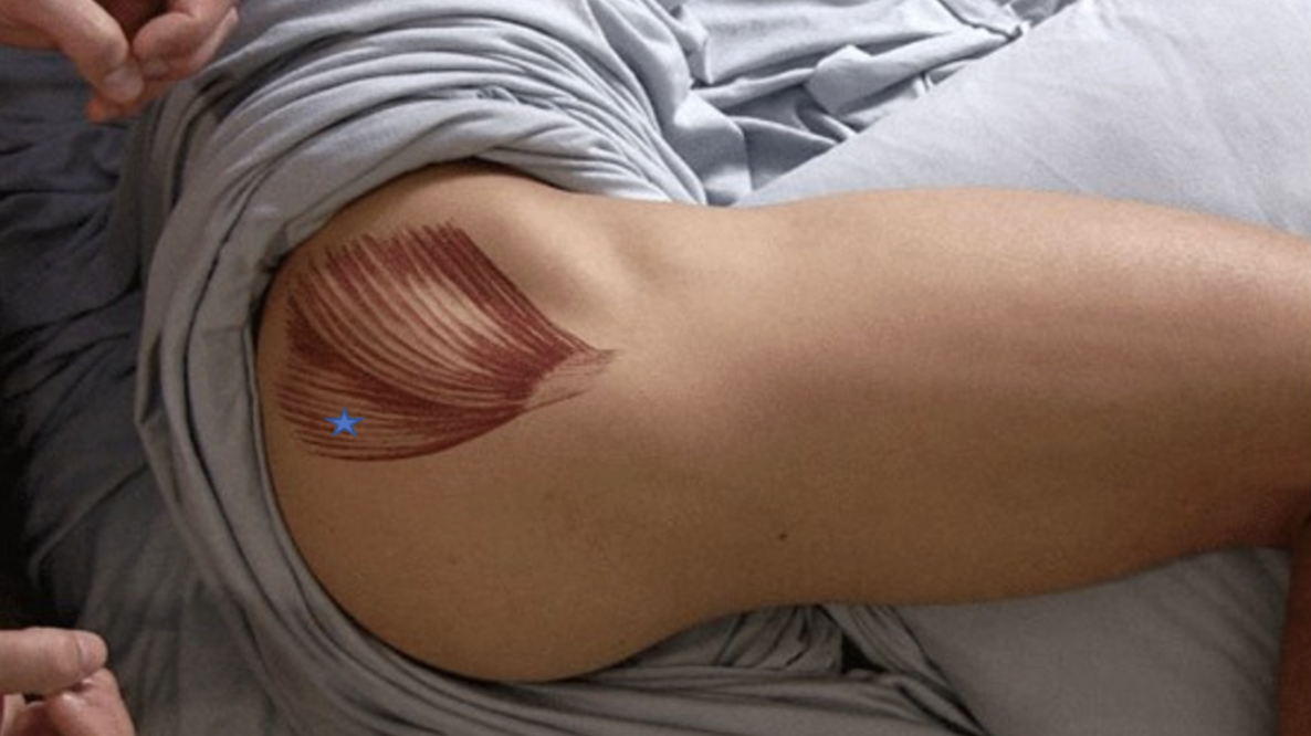 <p><span>From the list of muscles and actions below, identify the "starred" muscle and its primary actions.</span></p>