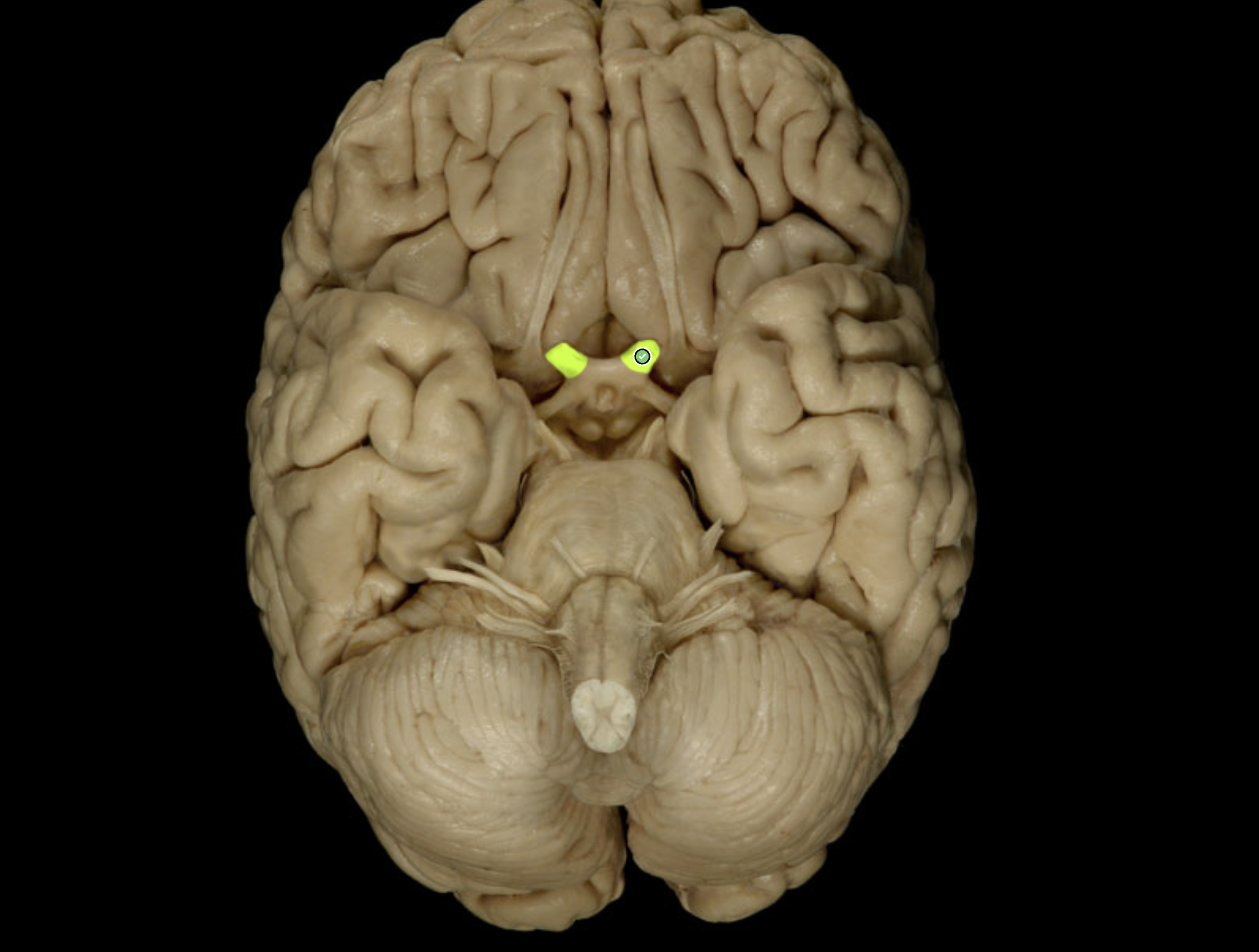 <p>Which nerve is labeled?</p>