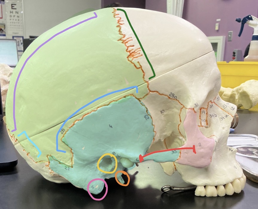 <p>what is the dark green indicated suture?</p>
