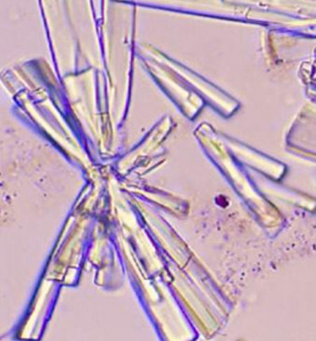 <p>what crystal; acid or alk</p>