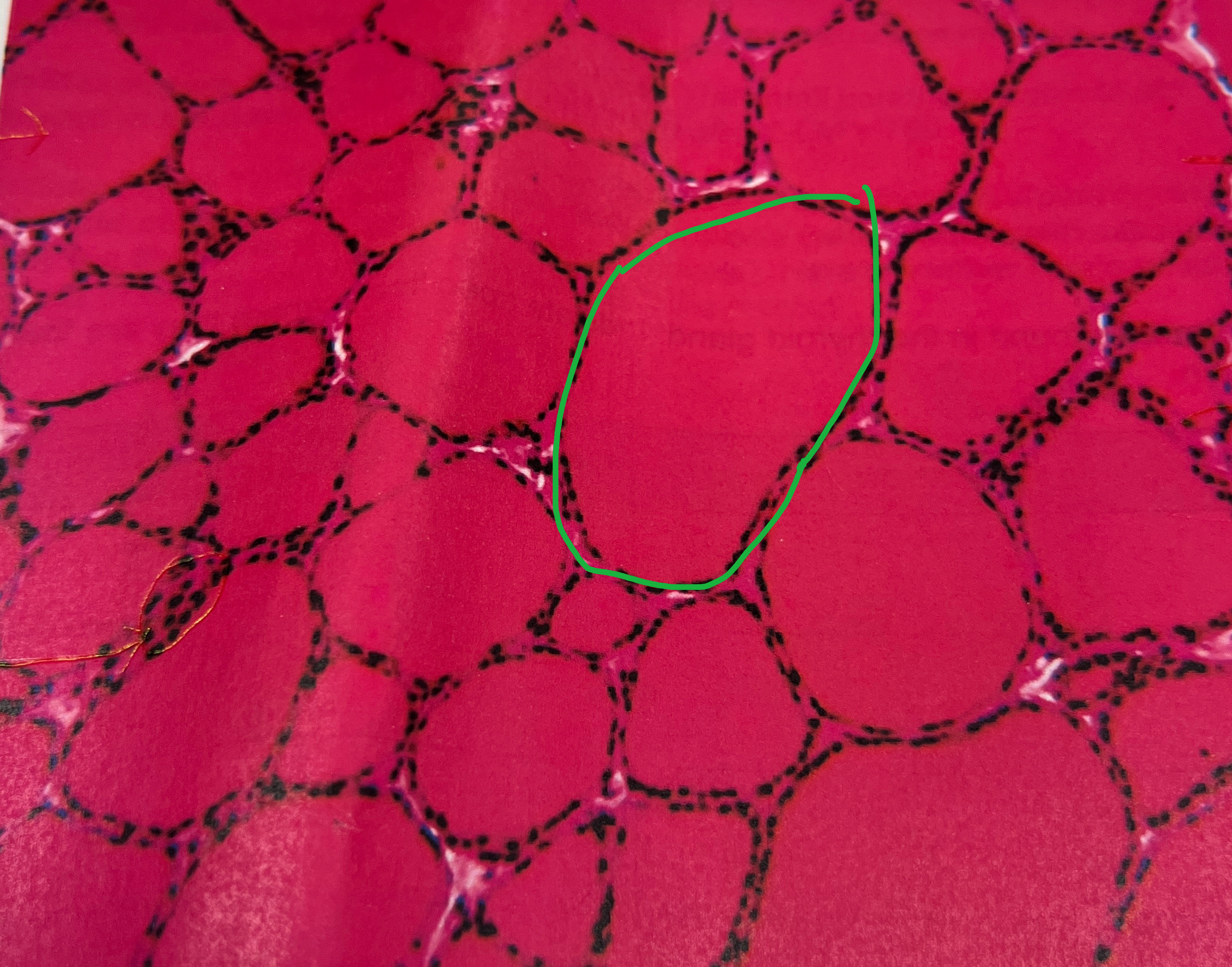 <p>What are the spherical shapes called in the thyroid gland?</p>