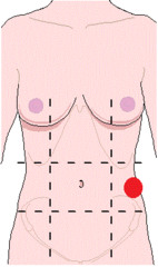 <p>identify the region of the abdomen:</p>