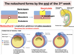 <p>Notochord</p>