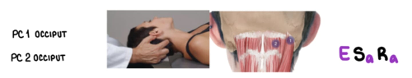 <p>Patient will be supine!</p><ul><li><p>PC1 Inion = FStRa (on inferior nuchal line, lateral to inion)</p></li><li><p>PC1 Occiput = ESaRa (on inferior nuchal line btwn inion and mastoid)</p></li><li><p>PC2 Occiput = ESaRa (inferior nuchal line within semispinalis capitis m.)</p></li><li><p>PC2 SP = ESaRa (superior aspect)</p></li><li><p>PC3 SP = FSaRa (inferior aspect of one above)</p></li><li><p>PC4-8 SP = ESaRa (inferior aspect of one above)</p></li><li><p>c3-7 articular = ESaRa (posterolateral aspect)</p></li></ul><p></p>