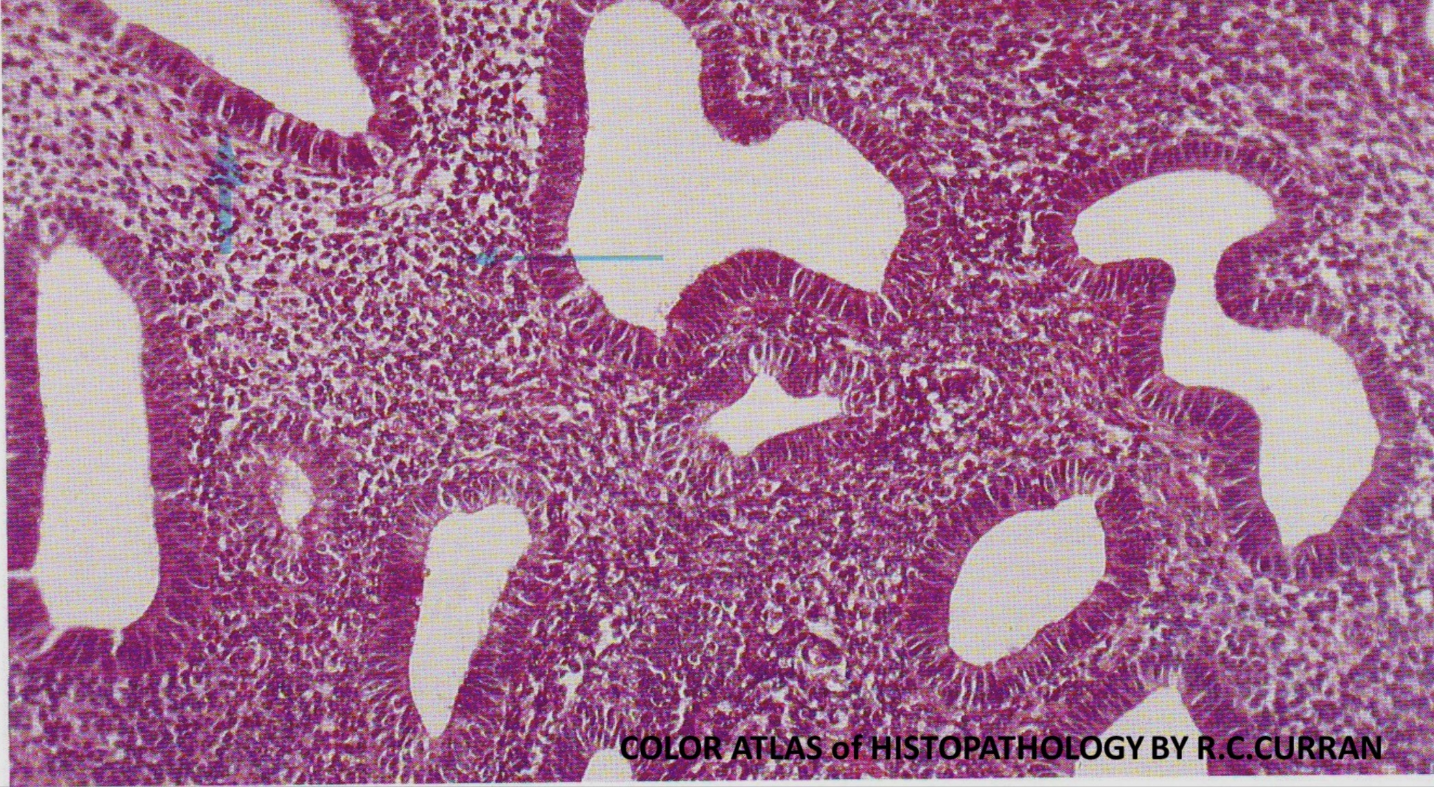 term image