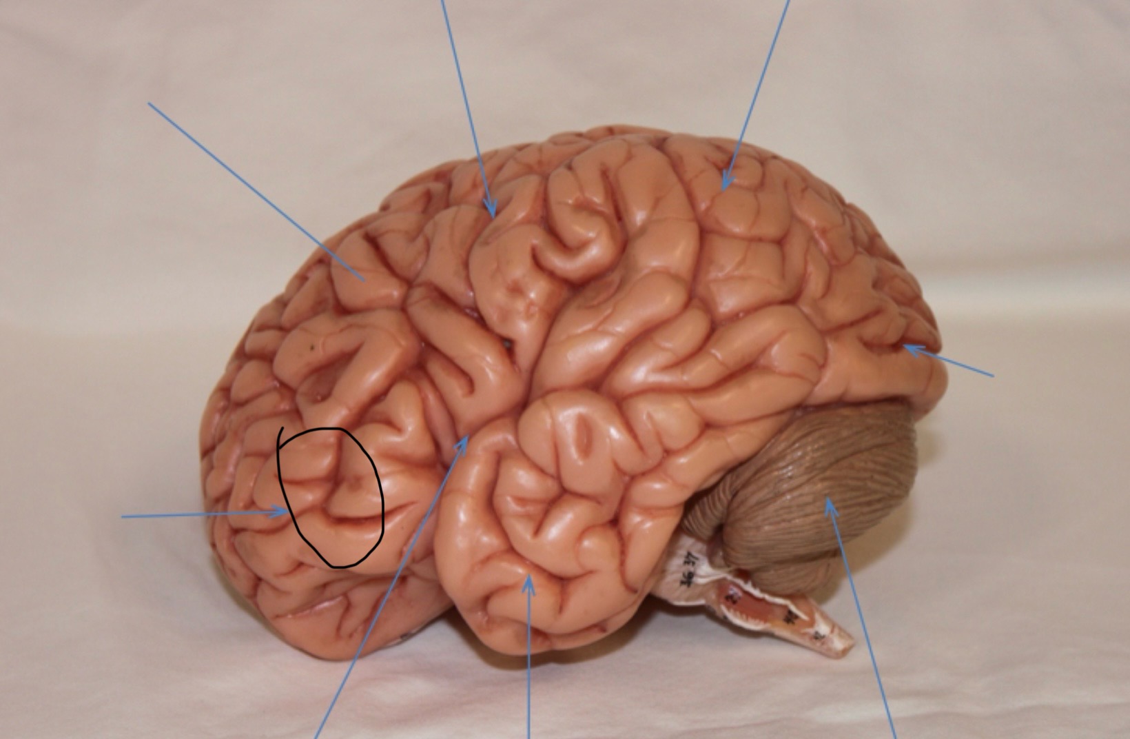 <p>Identify the circled area?</p>