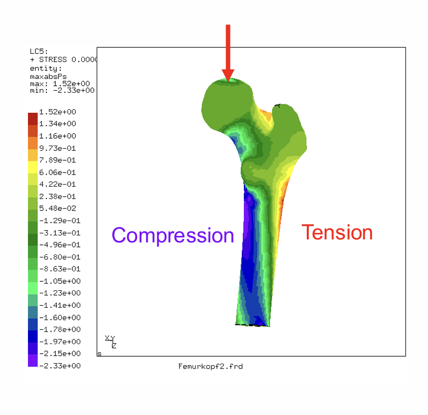 <p>Edges! There is denser bone there. Bone architecture follows directions of principal stresses</p>