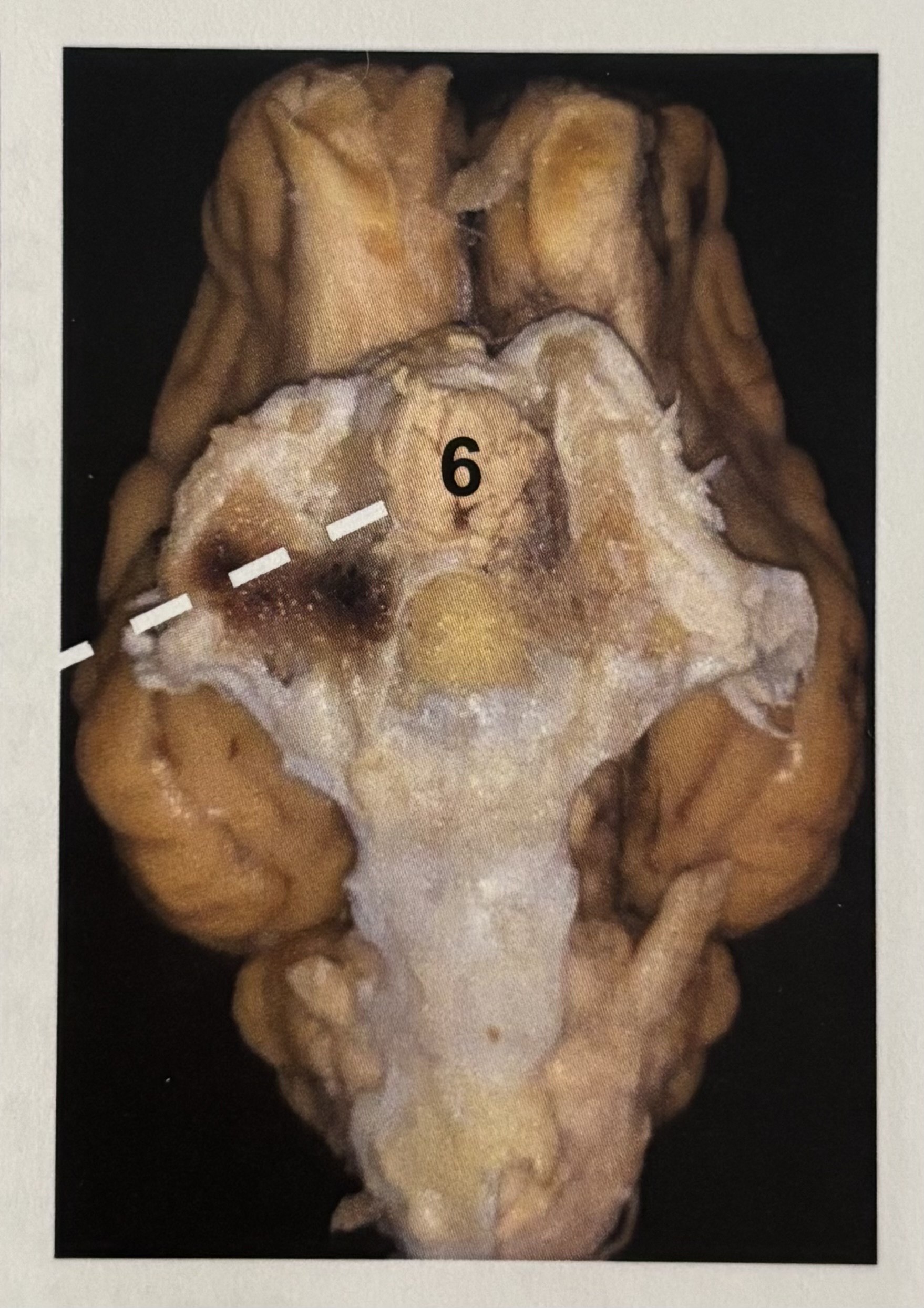 <p>6</p>