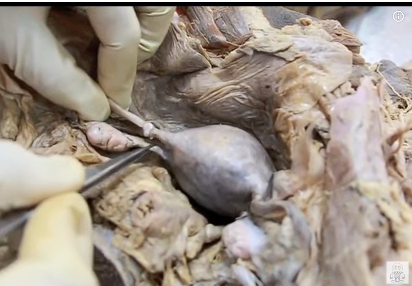 <p>below and behind uterine tube</p>