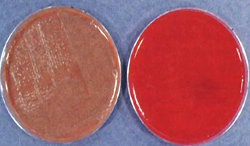 <p>enrichment; fastidious<br><br>lysed; hemoglobin; X; V</p>