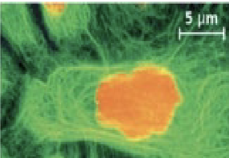 <p>Intermediate filaments are the most ____ of the fibers and are the least _____</p>