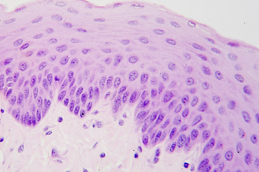 <p>Name the epithelium & give example </p>
