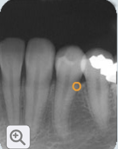 <p>alveolar crest</p>