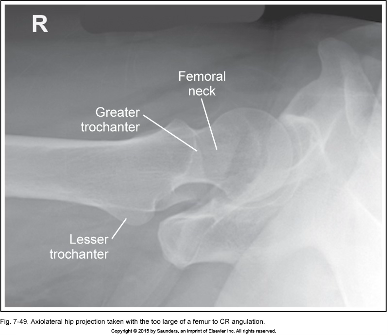 <p>hip axiolateral (danelius-miller/x-table)</p>