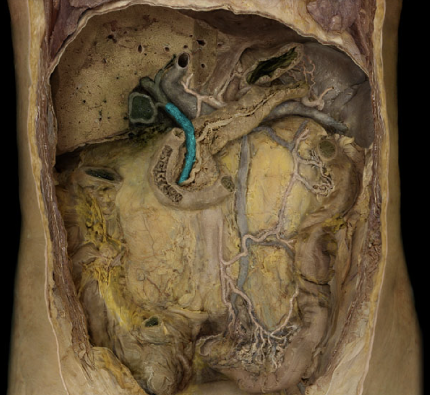 term image