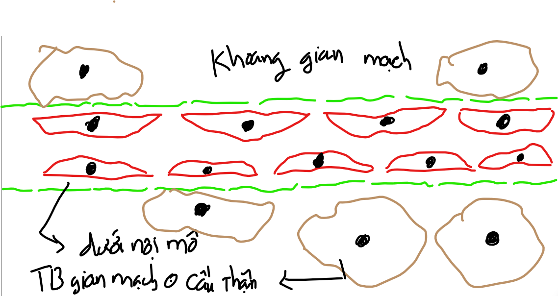 <ul><li><p>Căn nguyên:</p></li></ul><p>→ Lắng đọng phức hợp MD tại cầu thận</p><p>→ RL hoạt hóa bổ thể</p><ul><li><p>Diễn biến:</p></li></ul><h2 id="f000a2fc-1467-42e2-b08b-d23837bd7b33" data-toc-id="f000a2fc-1467-42e2-b08b-d23837bd7b33" collapsed="false" seolevelmigrated="true">Lắng đọng PHMD cầu thận:</h2><p>- Các nguyên nhân gây nên tình trạng cơ thể sản xuất KN liên tục: + Nhiễm trùng mạn tính</p><p>+ Bệnh tự miễn (Lupus, Viêm khớp dạng thấp,….)</p><p>+ Ung thư</p><p>+ Suy giảm khả năng thanh lọc của hệ thống thực bào</p><p>- Khi này, các KN còn tồn dư trong máu sẽ được KT gắn vào và hình thành nên các PHMD.</p><p>- Các PHMD này sẽ đi trong máu, tới mao mạch cầu thận.</p><p>- Vì mao mạch cầu thận là mao mạch không liên tục với lớp màng đáy có lỗ thủng. Do đó, các PHMD có thể “lọt” xuống những cái lỗ này và mắc kẹt tại các vị trí:</p><ul><li><p>Lớp dưới nội mô (giữa màng đáy với nội mô)</p></li><li><p>Khoảng gian mạch (xen kẽ giữa các mạch máu→chui hẳn ra ngoài lòng mạch)</p></li></ul><p>→ Điều này dẫn đến sự hoạt hóa bổ thể tại các vị trí mắc kẹt → gây viêm mạn tính phá hủy âm thầm và từ từ → Các tổ chức phải liên tục sửa chữa và thay đổi để thích nghi:</p><ul><li><p>TB nội mô: To hơn, nhiều hơn</p></li></ul><p>→ Dày nội mô → hẹp lòng mạch → thiếu máu tưới thận</p><ul><li><p>Màng đáy: Dày hơn </p></li></ul><p>→ Thiếu máu nuôi TB gian mạch trong cầu thận</p><p>→ ⭣eGFR</p><ul><li><p>TB gian mao mạch trong cầu thận: Nhiều hơn, to hơn</p></li></ul><p>→ Lấp đầy khoang gian mạch cầu thận → Đè ép các mao mạch làm nó hẹp hơn, đồng thời làm tốc độ lọc chậm hơn.</p><h2 id="f2a39e15-a5d9-4ebf-9503-51af04d79735" data-toc-id="f2a39e15-a5d9-4ebf-9503-51af04d79735" collapsed="false" seolevelmigrated="true">RL HHBT theo con đường thay thế:</h2><p>- Thông thường, con đường thay thế của HHBT chính là sự tự HHBT ngay trên bề mặt tế bào và luôn xảy ra ở mức “nền” do sự điều hòa ức chế bởi các yếu tố điều hòa bổ thể. Tuy nhiên, khi các các yếu tố điều hòa bổ thể này bị thiếu hụt 1 cách tương/tuyệt đối → Con đường thay thế của HHBT được “thả phanh” → mất kiểm soát → gây viêm mạn tính.</p><p></p>