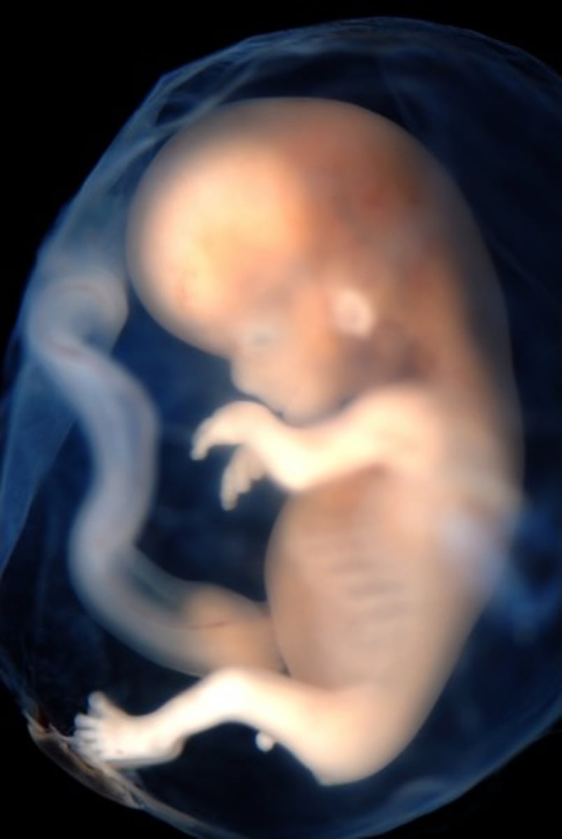 <p>9 weeks to birth</p>