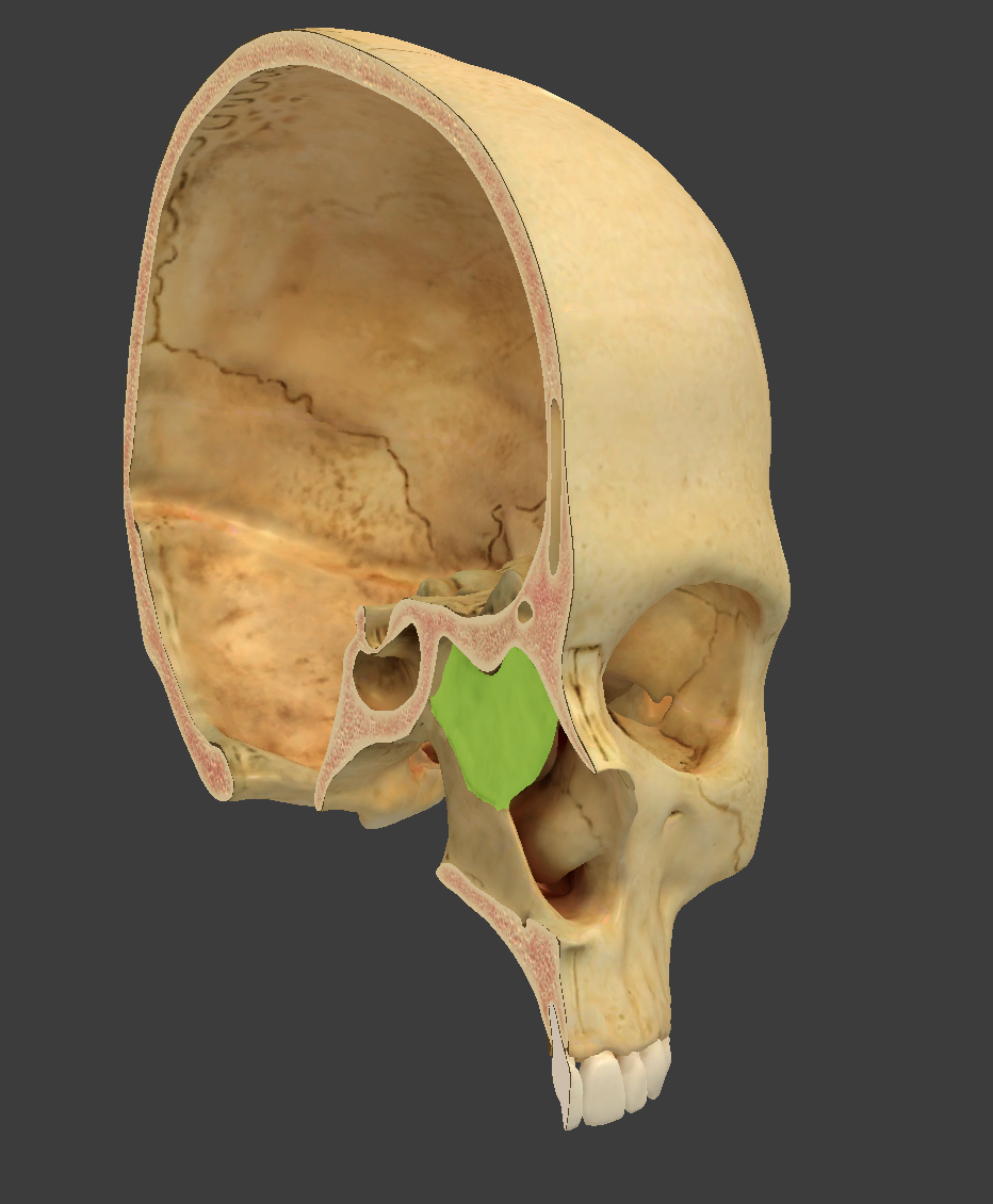 term image