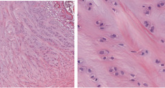 <p>What causes the pink staining of the extra cellular matrix of this fibrocartilage?</p>