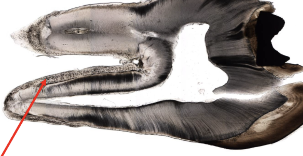 <p>located in the tooth root outside the dentin</p>