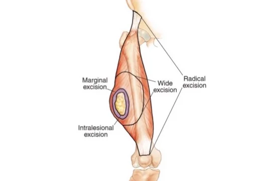 <p>d. all of the above </p>