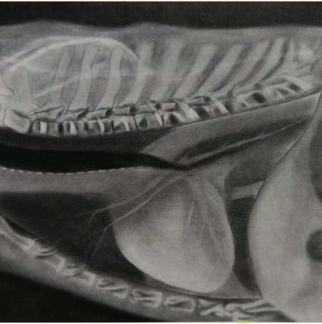 <p>Mitral insufficiency</p>