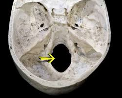 <p>What is this pointing to? What bone is it on?</p>