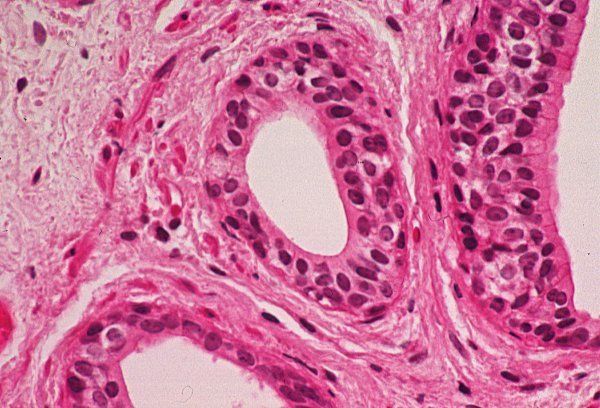 <p>Two layers </p><p>Square-shaped </p><p>Almost no diffusion between them</p><p>Usually found in tubes associated</p><p>with glands </p>