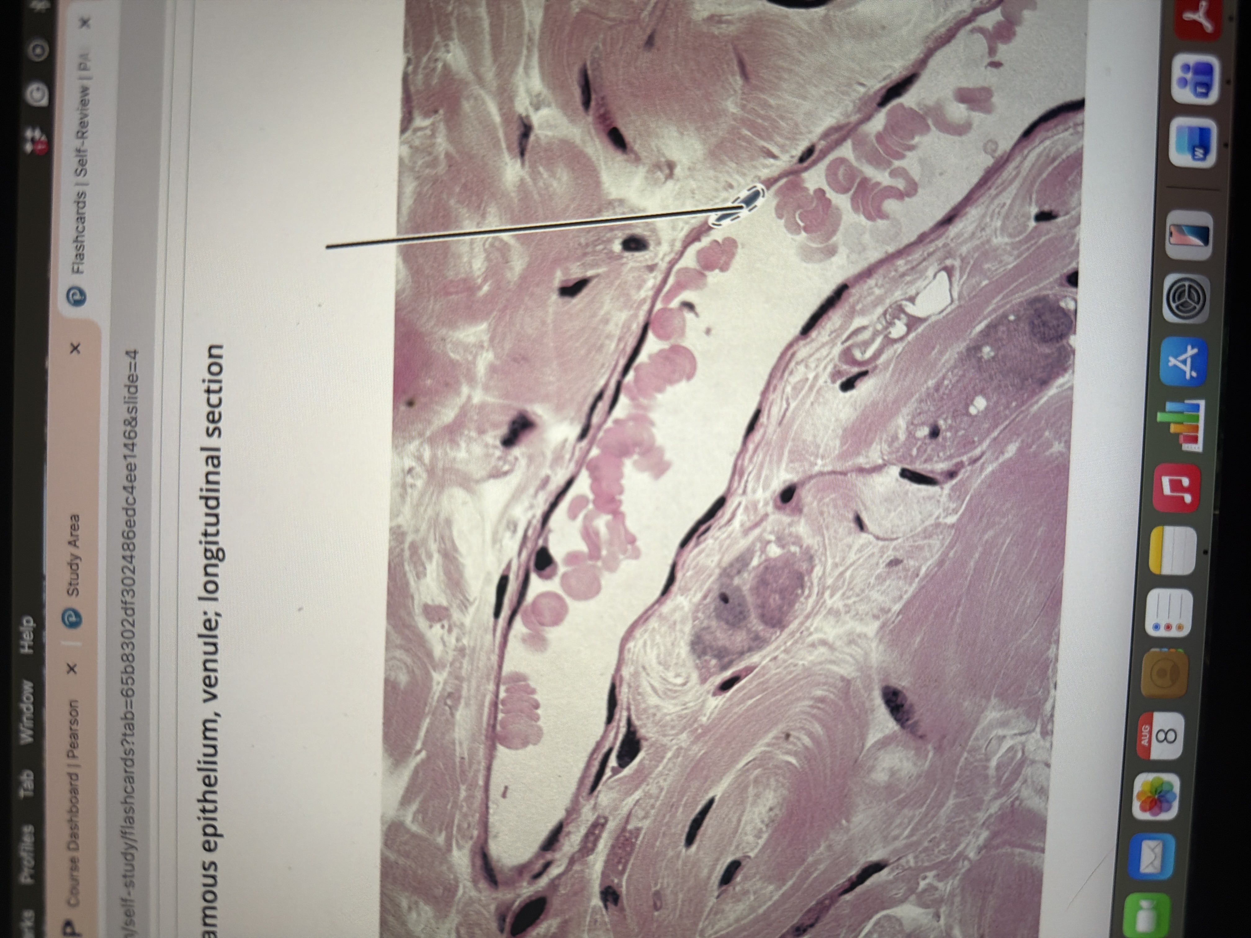 <p>Simple squamous epithelium </p>