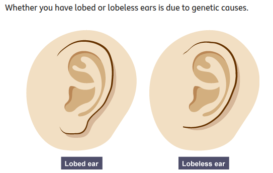 <ul><li><p>Genetic causes — the genes they have inherited</p></li><li><p>Environmental causes — the conditions in which they have developed</p></li><li><p>A combination of genes and the environment</p></li></ul><p></p>