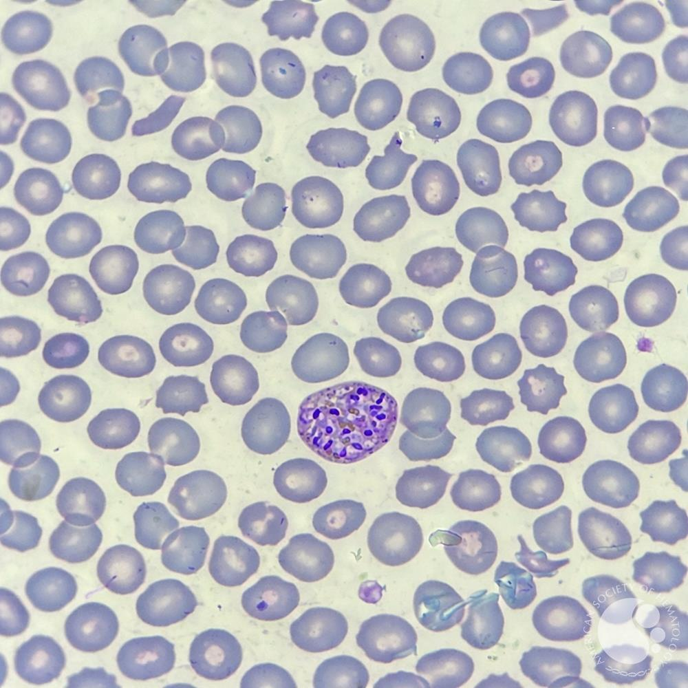 <p>12-24 merozoites in young RBCs?</p>