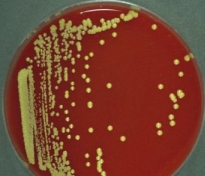 <p>Commensal, free-living GPC</p><p>Often arranged in regular packets of 4 or 8 <strong>(tetrads</strong>)</p><p><strong>CAT+ / COAG -</strong></p><p>Appear <strong><mark data-color="yellow" style="background-color: yellow; color: inherit;">yellow</mark></strong> and non-hemo on BAP</p><p>Generally contaminants</p>