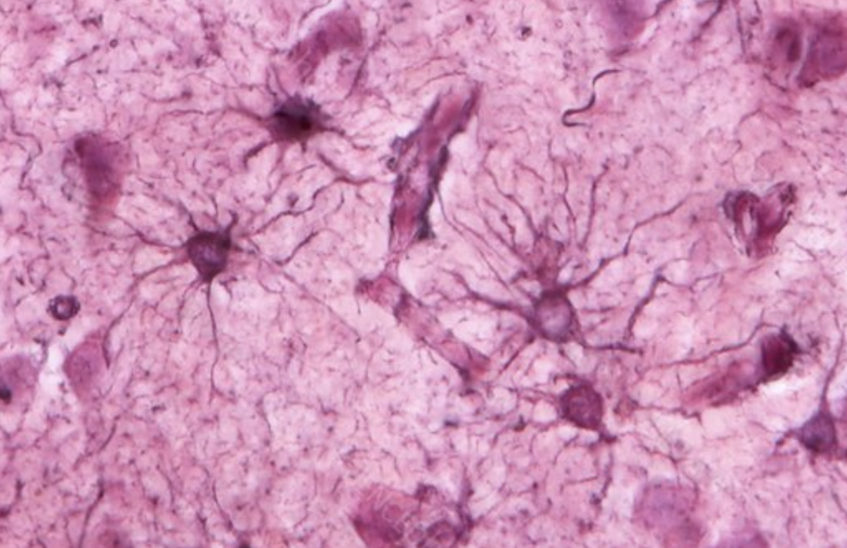 <p>They are one of four different types of CNS glial cells and are the most abundant</p><p>Functions include:</p><ul><li><p>help form blood-brain barrier</p></li><li><p>regulate interstitial fluid composition</p></li><li><p>form structural support</p></li><li><p>assist neuronal development'</p></li><li><p>alter synaptic activity</p></li><li><p>occupy the space of dying neurons</p></li></ul><p></p>