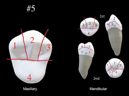 <ul><li><p>3 Buccal</p><ul><li><p>mesiobuccal</p></li><li><p>middle buccal</p></li><li><p>distobuccal</p></li></ul></li><li><p>1 Lingual</p></li></ul><p></p>