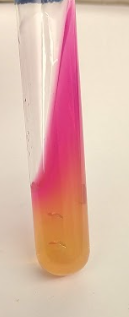 <p>Question options:</p><p>This bacteria produces the enzyme urease that degrades urea.</p><p>This bacteria ferments the sugar urea.</p><p>This bacteria does not ferment the sugar urea.</p><p>This bacteria does not produce the enzyme urease that degrades urea.</p>