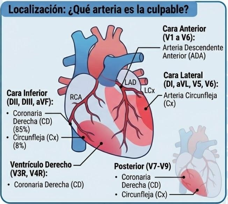 <ul><li><p>Cara anterior → V1 a V6 → Arteria descendente anterior</p></li><li><p>Cara lateral → DI, aVL, V5, V6 → Arteria circunfleja</p></li><li><p>Cara inferior → DII, DIII, aVF → Arteria coronaria derecha o circunfleja</p></li><li><p>Ventrículo derecho → V3R, V4R → Arteria coronaria derecha</p></li><li><p>Cara posterior → V7 a V9 → Arteria coronaria derecha o circunfleja</p></li></ul><p></p>