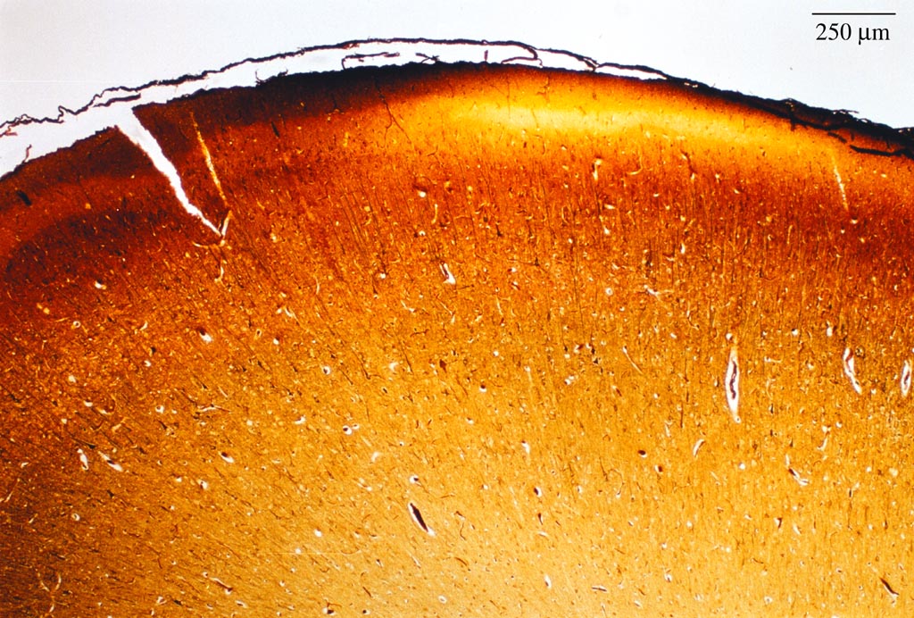 <p>Identifica la plaquita</p>