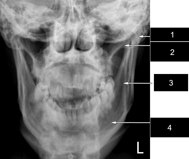 <p>label 1</p>