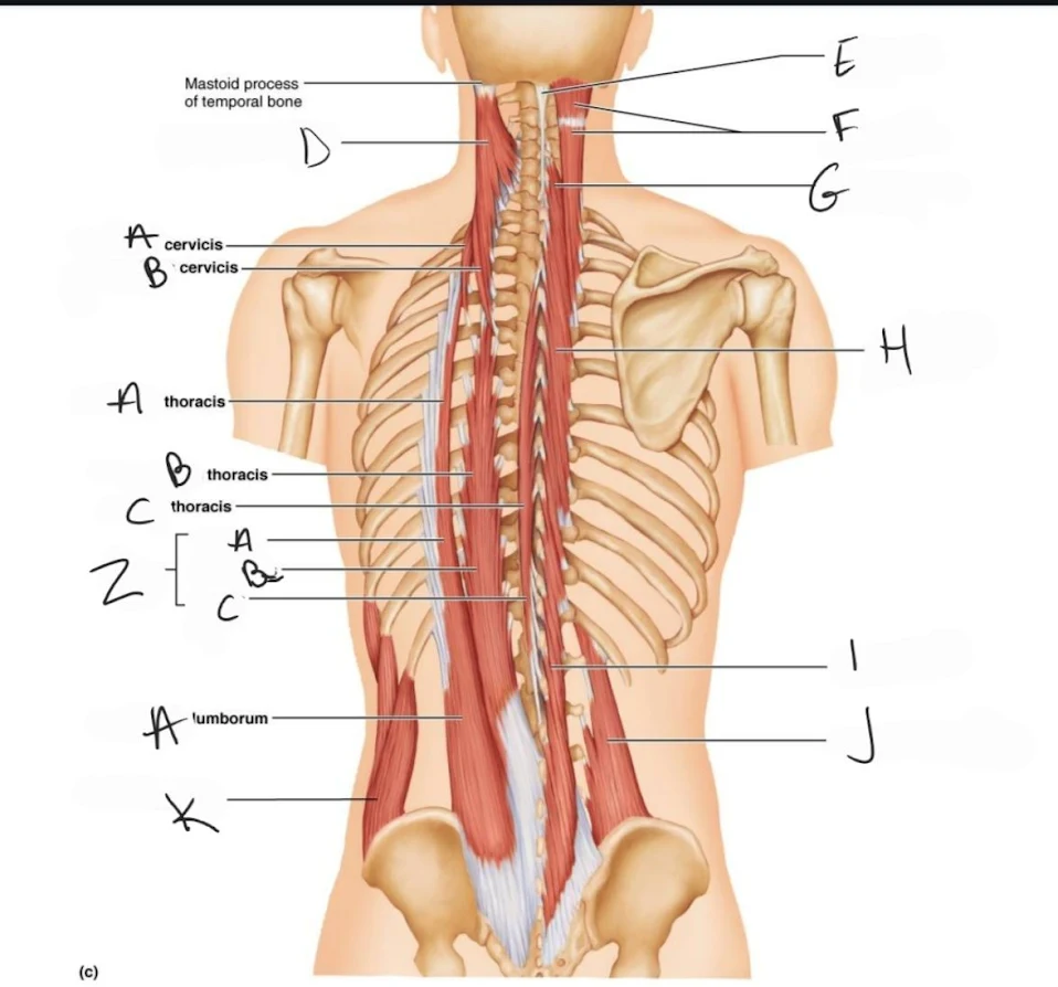 <p>semispinalis capitis</p>