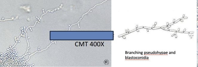 <p>ID the type of yeast </p>