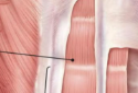 <p>what is this muscle?</p>