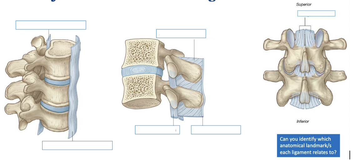 <p>major vertebral column ligaments</p>