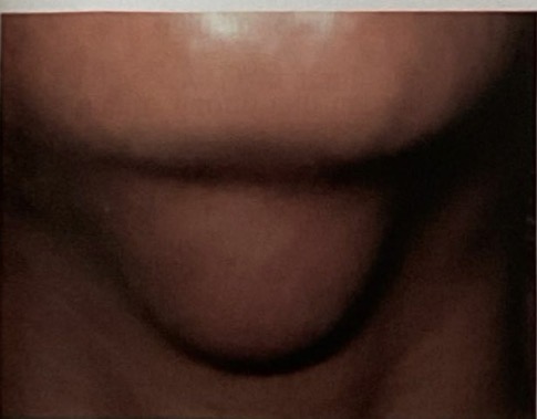 <p>CHẨN ĐOÁN?</p>